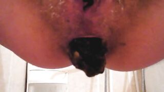 Hairy hole and black turd