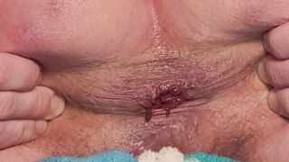 Holding my asshole open