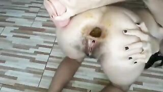 Closeup Anus Insertions