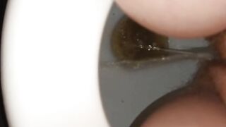 Pee and poop together