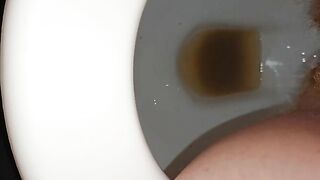 Pee and poop together