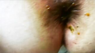 Hairy hot scat wife getting drilled hard