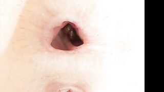 Dirty assholes up close