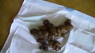 Women shit in ultimate candy mix