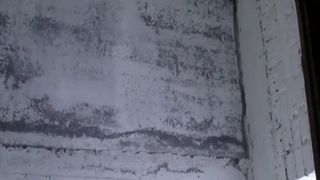 Hairy girl has diarheea