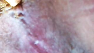 Shaved girl shitting yellow shit in close up