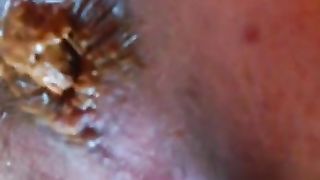 Shaved girl shitting yellow shit in close up