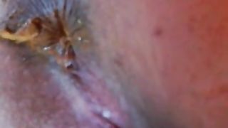 Shaved girl shitting yellow shit in close up