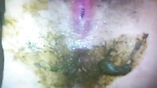Interracial scat anal sex