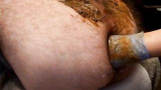 Dirty wife fisting her tight butthole