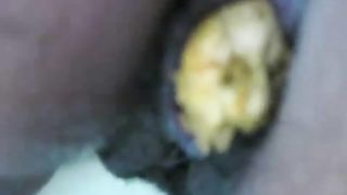 Nurse shitting a long yellow turd over a toilet