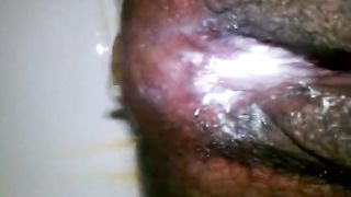 Creampied hairy wife pooping in close up