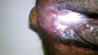 Creampied hairy wife pooping in close up