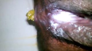 Creampied hairy wife pooping in close up