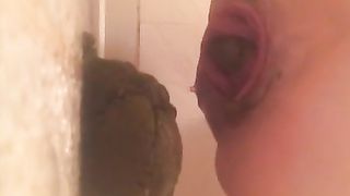 Anal prolapse after pooping a big pile of shit