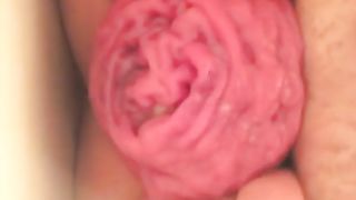 Prolapse after pooping a tiny one