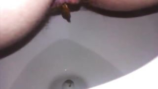 Wife got a turd stuck in her ass
