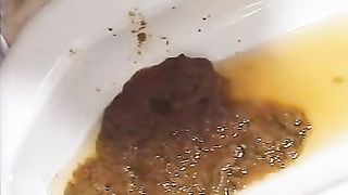 Japanese nurse has diarheea