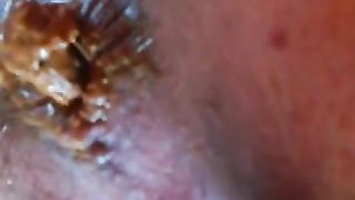 Close up of sexy teen pooping small turd