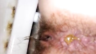 Hairy girl has a yellow shit stuck in her ass