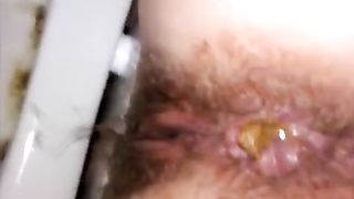 Hairy girl has a yellow shit stuck in her ass