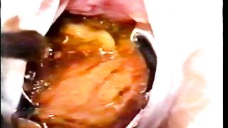 Two school girls pooping together