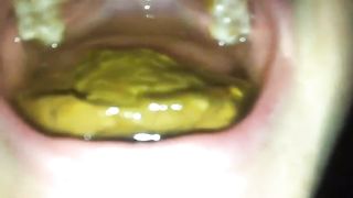 Skinny german teen eating poop from her boyfriend