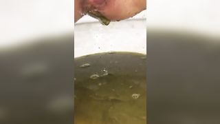 Diarheea in close up