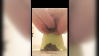 Girl with anal prolapse and pumped pussy