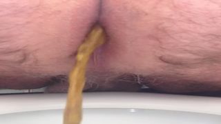 Hairy guy shitting in toilet