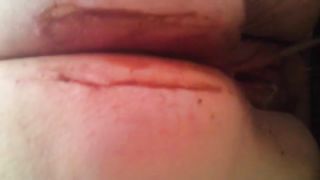 Very fat lady shitting in close up