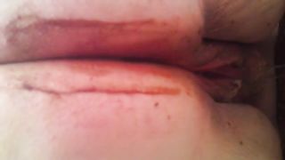 Very fat lady shitting in close up