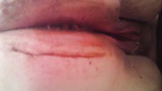 Very fat lady shitting in close up