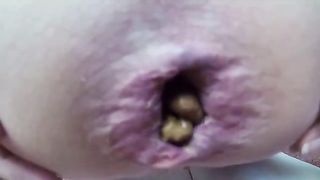Amateur girls shitting huge turds