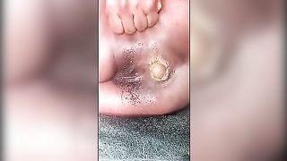 Yellow turd from black ass