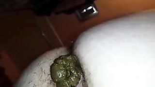 Hairy girl shitting a big one