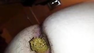 Hairy girl shitting a big one