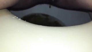 Shaved girl with diarheea