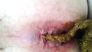 Hairy dude pooping