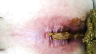 Hairy dude pooping