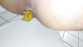 Dilated asshole poop
