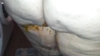 She has serious diarheea