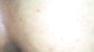 She has serious diarheea