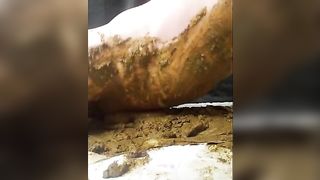 He can't stop pooping in diapers